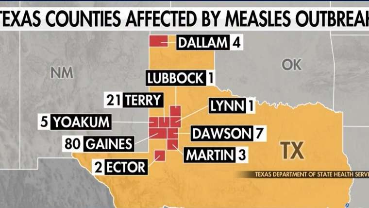 Measles Outbreak in Texas: Guide for Families