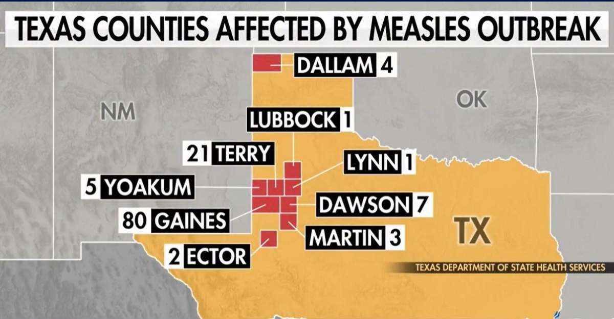 Measles Outbreak in Texas: Guide for Families