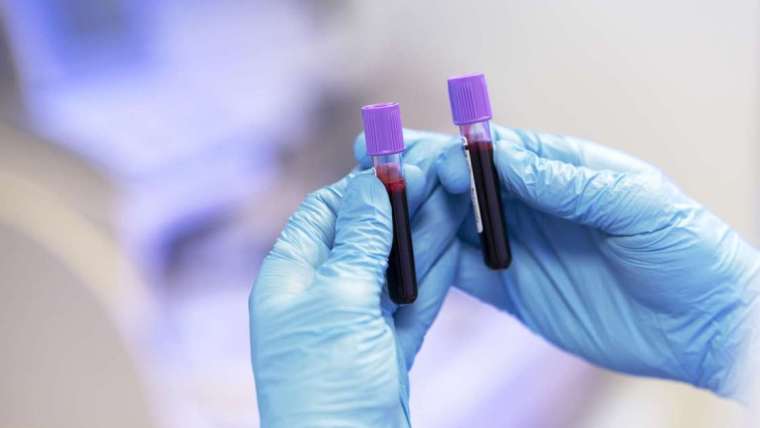 Arterial Blood Gas test - ABG test
