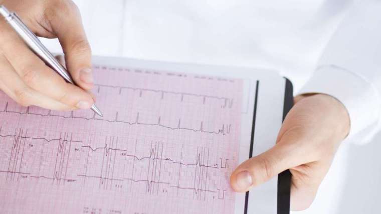 What Your Electrocardiogram EKG Can Reveal About Your Heart