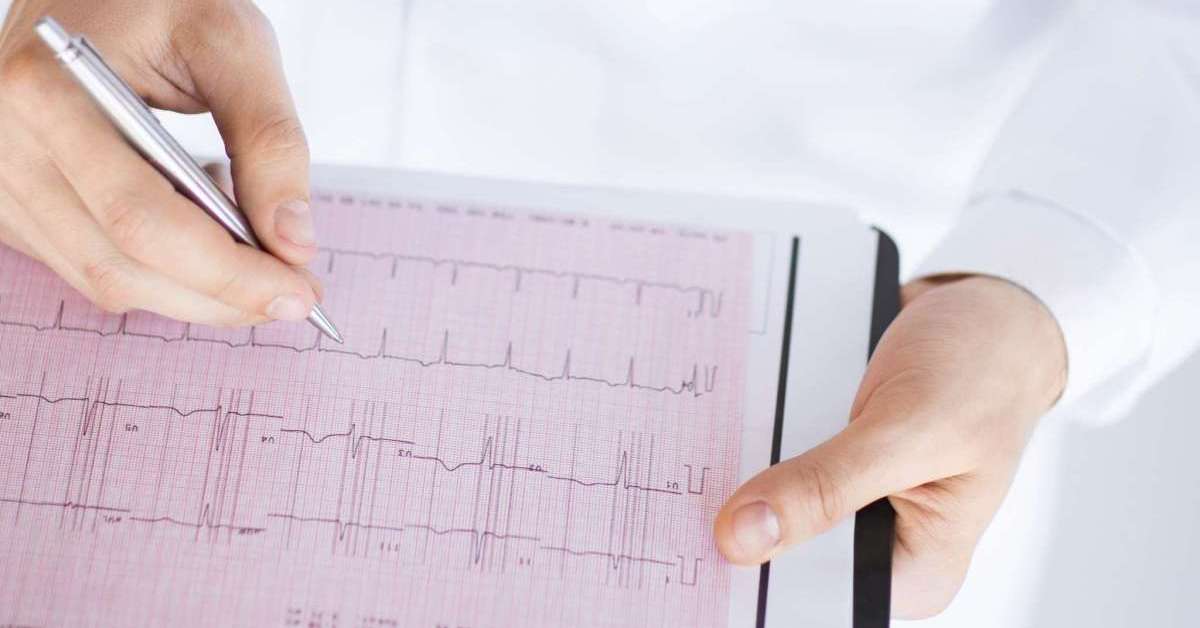What Your Electrocardiogram EKG Can Reveal About Your Heart