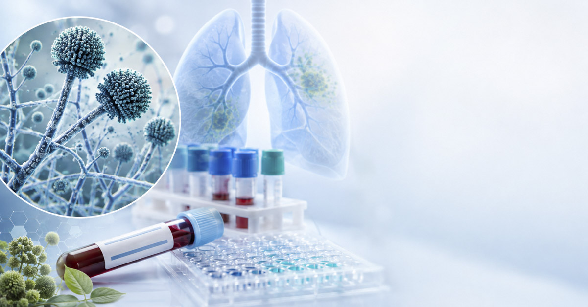 What is Aspergillus Galactomannan