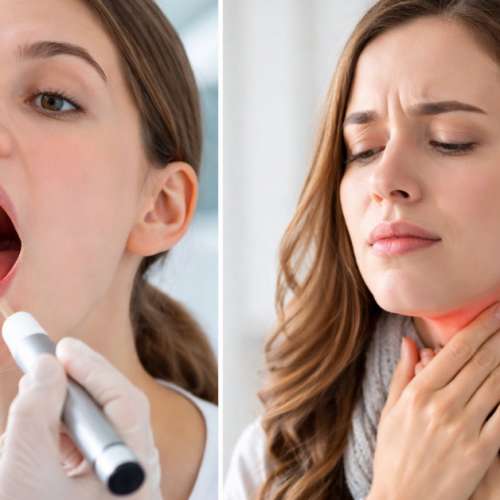Strep Throat vs Sore Throat - How to Tell the Difference