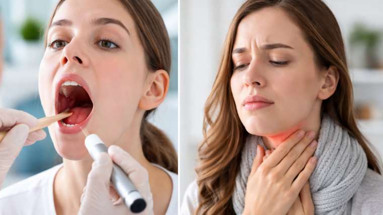 Strep Throat vs Sore Throat - How to Tell the Difference